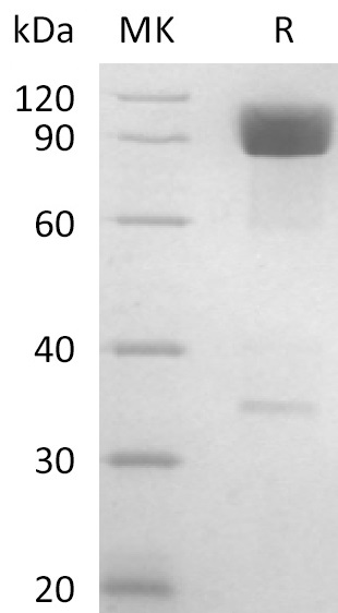 Human CD98 +SDS-PAGE-1.jpg